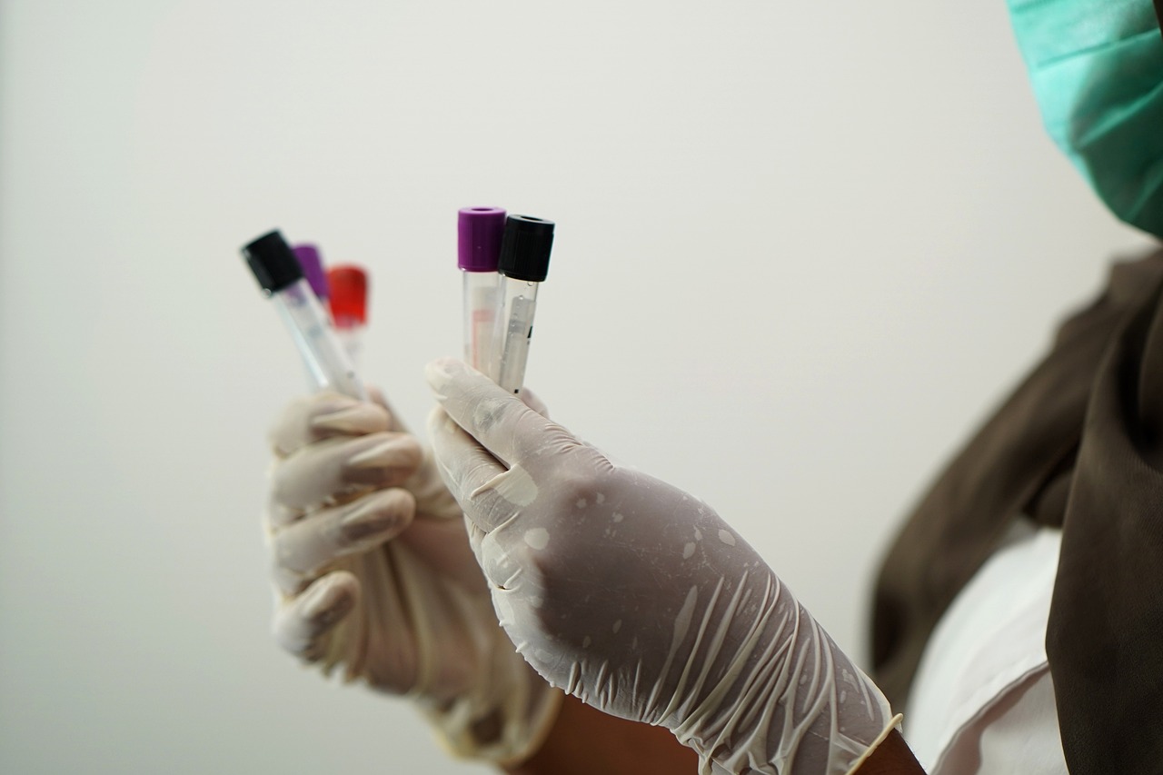 blood lab still
